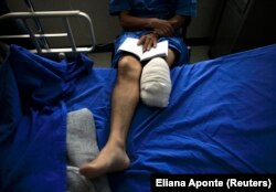 Imigran Honduras Jeremias Hernandez menunjukkan kakinya yang diamputasi di sebuah rumah sakit di Lecheria, Tultitlan, 4 Agustus 2010. (Foto: REUTERS/Eliana Aponte)