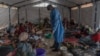 FILE - Doctor Robert Musole, medical director of the Kavumu hospital, visits patients recovering from mpox in the village of Kavumu, 30 kilometers north of Bukavu in eastern Democratic Republic of Congo on Aug. 24, 2024.