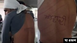 পাঞ্জাবের জেলে কয়েদির পিঠ চিরে লেখা ‘আতঙ্কবাদী’। (ছবি- দ্য ওয়াল) 