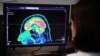 Estudio descubre el mecanismo del cerebro para regular la sensación de dolor