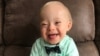 La contagiosa sonrisa de Lucas Warren, un bebé Down, será la nueva imagen de la marca de alimentos Gerber.