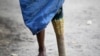 Oo Taung, 50, who lost his leg in a land mine blast in 1994 stands after taking a bath in Zawti village in Kyaukki township January 24, 2013. More than 300 people in Kyaukki Township (population 115,200) in Northern Bago Division, adjacent to once war-tor (ယခင်မှတ်တမ်းဓါတ်ပုံ)