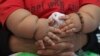 FILE - An eight-month-old boy is held by his mother as they wait to see a doctor at a clinic for the obese in Bogota, March 19, 2014.